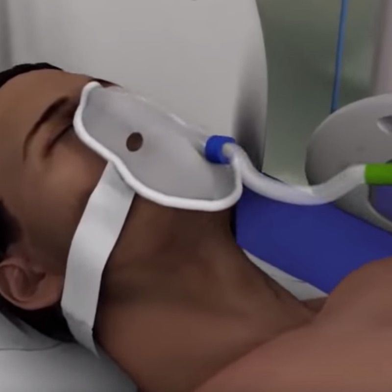 Here_s_how_ventilators_can_save_coronavirus_patients_-_YouTube Here_s_how_ventilators_can_save_coronavirus_patients_-_YouTube